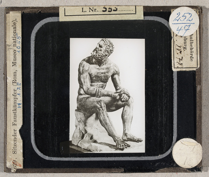 Vorschaubild Rom, Museo Nationale: Sitzender Faustkämpfer (Krüss-Nr. 8629) 